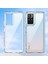 Xiaomi Redmi Note 11 4g Telefon Kılıfı (Yurt Dışından) 2
