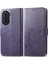 Huawei Nova 10 Pro Kılıf Için Kılıf Kısa Kayış Zarif Iş (Yurt Dışından) 1