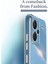 Xiaomi Redmi Note 13 Pro+ 5g Yumuşak Tpu Kılıfı Elektraplama Şok Geçirmez Telefon Kapağı (Yurt Dışından) 5