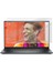Dell Inspiron 15 5515 15.6 Inç Mat Ekran Koruyucu Şeffaf 1