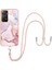 Xiaomi Redmi Için Not 11 4g Mermer Crossbody Kordon Askısı Tampon (Yurt Dışından) 1