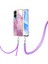 Onur Için Kılıf 90 Lite 5g Mermer Crossbody Kordon Askısı Tampon Yumuşak (Yurt Dışından) 3