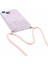 iPhone 13 Slim Kirkarlı Parıltılı Epoksi Tpu TeIefon Kılıfı (Yurt Dışından) 4