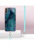 Xiaomi Redmi 9A Yumuşak Tpu Tampon Mermer Kapak Ayrılabilir Kayış (Yurt Dışından) 5