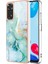Xiaomi Redmi Not 11S/NOT 11 4g (Yurt Dışından) 1