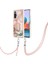 Xiaomi Redmi Için Not 10 Pro/pro Max Yumuşak Tpu Tampon Ayrılabilir Kayış (Yurt Dışından) 4