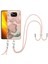 Xiaomi Poco X3/x3 Pro Kapak Mermer Yumuşak Tpu Tampon Ayrılabilir (Yurt Dışından) 1