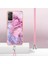 Xiaomi Redmi Not 11 Pro Için Kılıf (Yurt Dışından) 4