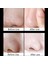 5 Adet Tarzı 20G Yüz Remover Maske Krem Cilt Bakımı Burun Temizleme (Yurt Dışından) 4