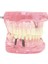 Diş Diş Modeli Öğretme Çalışması Oral Implant Restorasyonu ve Patoloji Pembe (Yurt Dışından) 1