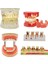 M4010 Tarzı Diş Patolojik Typodont Diş Modeli Periodontoloji Implant Endodontik Çürük Tedavisi Typodont Modeli Yetişkin Çocuk Diş (Yurt Dışından) 2