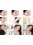 3D Massager Masaj Aleti 4