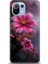 Xiaomi Mi 11 Lite Uyumlu Kılıf Hd Baskılı Kılıf - 311 1
