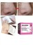 Burun Temizleme Macunu Burun Bandı Giderici 60 Kullanımlık Maske 30 Gr/60 Strips 4