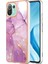 Xiaomi 11 Lite Için Kılıf (Yurt Dışından) 1