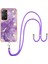Xiaomi Redmi Için Not 11 4g Mermer Crossbody Kordon Askısı Tampon (Yurt Dışından) 1