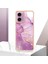 Motorola Moto G24 4G/G04 4g Ince Tpu Mermer Desen Koruma (Yurt Dışından) 5