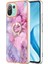 Xiaomi 11 Lite 5g Için Kılıf 360 &deg; Dönebilir Halka Mermer Darbeye Tpu (Yurt Dışından) 3