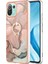 Xiaomi 11 Lite 5g Için Kılıf 360 &deg; Dönebilir Halka Mermer Darbeye Tpu (Yurt Dışından) 2
