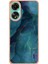 Oppo A78 4g Kılıf ile Uyumlu (Yurt Dışından) 3