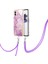 Nothing Kılıf Telefon 1 Anti-Scratch Yumuşak Crossbody Kordon Askısı Mermer (Yurt Dışından) 1