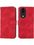 Honor 80 Telefon Kılıfı (Yurt Dışından) 1