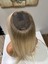 Tepe Kısmı Cilt Görünümlü Sabit Ayrımlı Gerçek Saç Tepelik 2