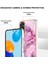 Xiaomi Redmi Not 11 4g Kılıf ile Uyumlu (Yurt Dışından) 5