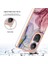 Oppo Oppo 10 Pro 5g Case ile Uyumlu (Yurt Dışından) 5