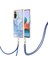 Xiaomi Redmi Için Not 10 Pro/pro Max Yumuşak Tpu Tampon Ayrılabilir Kayış (Yurt Dışından) 1