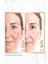 Anew Renewal Power Serum 10 Ml. 4
