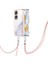 Onur Için Kılıf 90 5g Tampon Crossbody Kordon Askısı Mermer Anti-Scratch (Yurt Dışından) 1