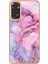 Xiaomi Redmi Not 11S Durumda ile Uyumlu (Yurt Dışından) 3