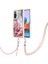 Xiaomi Redmi Için Not 10 Pro/pro Max Yumuşak Tpu Tampon Ayrılabilir Kayış (Yurt Dışından) 1
