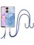 Oppo A78/A58 Için Durum (Yurt Dışından) 5