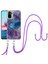 Xiaomi Redmi Için Not 10 4g/not 10S Mermer Kapak Yumuşak Tpu Tampon (Yurt Dışından) 1
