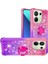 Xiaomi Redmi Note 13 4g Kılıf Için Bling Glitter Kickstand Tpu Kapak-Pembe + Mor (Yurt Dışından) 1