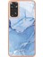 Xiaomi Redmi Not 11 4g Kılıf ile Uyumlu (Yurt Dışından) 5