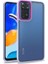 Redmi Note 11 Pro 5g Şık Görünümlü ve Arkası Şeffaf Flora Premium Kılıf 1