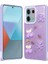 Redmi Note 13 Pro 5G Kılıf Lunessa Premium Figürlü Sert Silikon Kapak 1