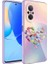 Huawei Nova 9 Se Uyumlu Kılıf Kamera Korumalı Desenli Sert Silikon Zore Epoksi Kapak, No1 1