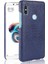 Xiaomi Redmi Not 5 Pro Anti Scratch Koruyucu Için Şık Klasik Durumda (Yurt Dışından) 1