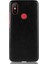 Xiaomi A2 Telefon Kılıfı (Yurt Dışından) 4