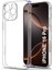 iPhone 16 Pro Şeffaf Silikon Kılıf 3D Kamera Korumalı Slim Fit Esnek Kapak 1