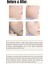 Soyucu Peeling Jel Krem 2 Adet 3