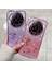 Xiaomi 14 Ultra Glitter Sparkle Yumuşak Tpu Telefon Kılıfı ve Kordon (Yurt Dışından) 2