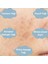 Antı-Blemısh Serum Leke Giderici Cilt Bakım Serumu 4