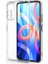 Redmi Note 11T 5g Kılıf Kamera Korumalı Şeffaf Onyx Tpu Süper Silikon Kapak 1