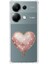 Xiaomi Redmi Note 13 Pro 4g Uyumlu Kalp Balon Desenli Silikon Kılıf 1
