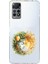 Xiaomi Redmi Note 11 Pro 4g Uyumlu Doğa ve Kadın Desenli Silikon Kılıf 1